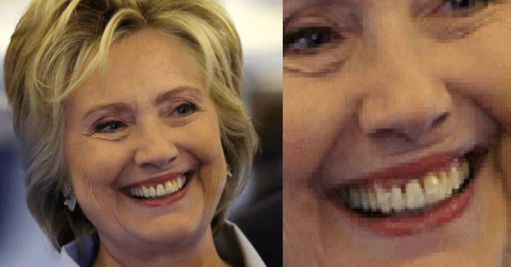 hillary-teeth